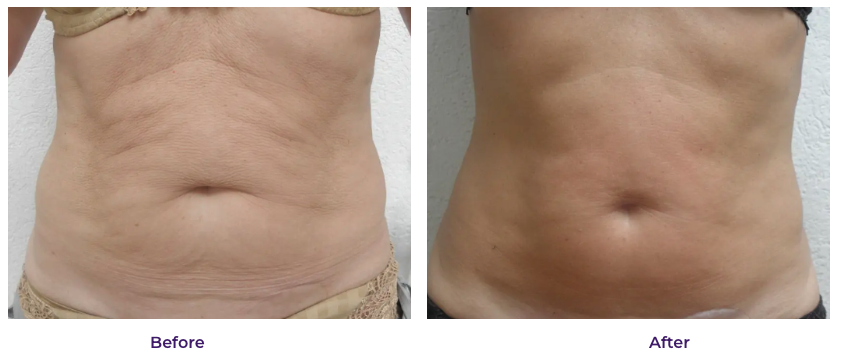 Screenshot 2024 02 13 at 3.14.49 PM